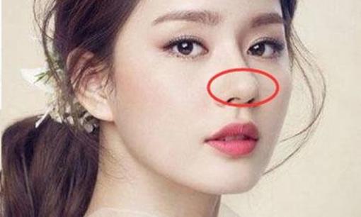 Người phụ nữ càng có nhiều thịt ở bốn bộ phận này thì chồng càng thịnh vượng và cô ấy sẽ được ban phước với nhiều may mắn và của cải trong suốt cuộc đời