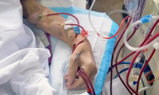 Suy thận giai đoạn cuối ở tuổi 30 khi ngó lơ các dấu hiệu, bác sĩ bệnh viện Bạch Mai cảnh báo