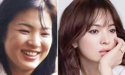 Song Hye Kyo thử '5 mẹo giảm cân lười biếng' và đã thành công mỹ mãn, rất đơn giản bạn cũng có thể làm được
