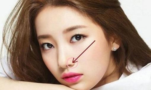 Nốt ruồi xấu trên mặt phụ nữ, theo tướng số nên tẩy để đổi vận sẽ tốt hơn