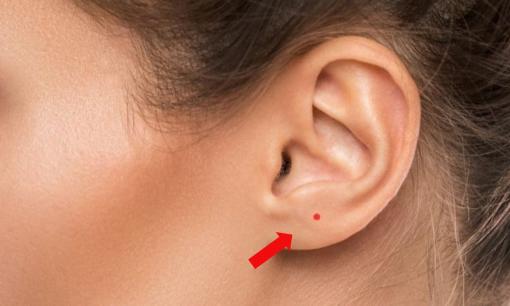 Nốt ruồi son ở từng vị trí trên cơ thể mang ý nghĩa thế nào?