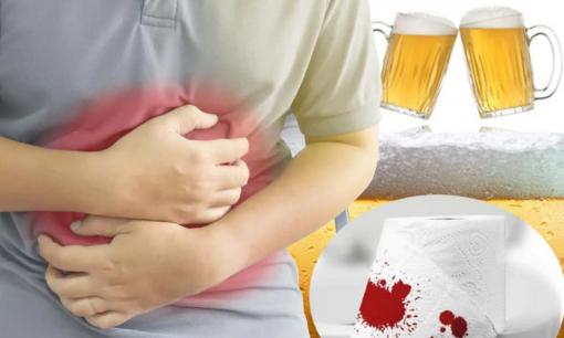 Chuyên gia cảnh báo: Nếu thấy 8 dấu hiệu này sau khi uống rượu bia cần đi cấp cứu gấp