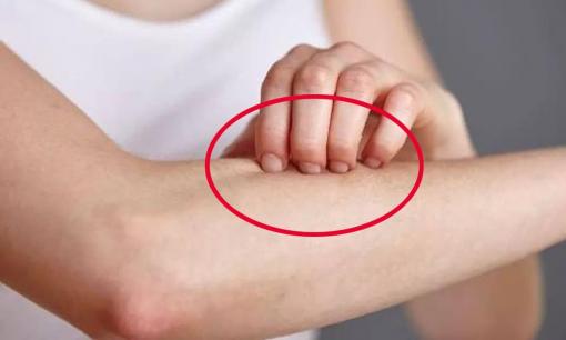 Nếu thấy hai chỗ trên người “ngứa ngáy” thì 9/10 là dấu hiệu của bệnh “tiểu đường”, đừng chần chừ đi kiểm tra