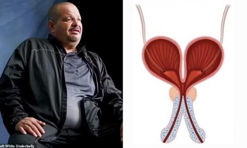 Người đàn ông đặc biệt có 2 'của quý' kể chuyện tình dục khác thường khiến ai nghe cũng đỏ mặt