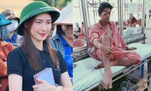 Sao Việt 11/10: Hoà Minzy tiếp tục ủng hộ đồng bào vùng lũ 500 triệu đồng; Nam ca sĩ Việt bị tai nạn liệt nửa mặt, ám ảnh vì ngoại hình biến dạng