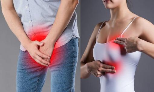 Dấu hiệu cảnh báo sớm ung thư ở nam giới và nữ giới: Dành 5 phút kiểm tra mỗi ngày để cứu cả cuộc đời