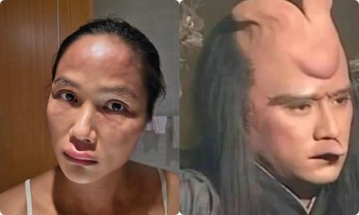 Chuyện gì xảy ra với gương mặt của Hoa hậu H'Hen Niê?