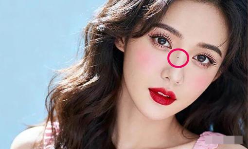 Những người có nốt ruồi ở 4 vị trí này sinh ra đã có “sự cao quý”!