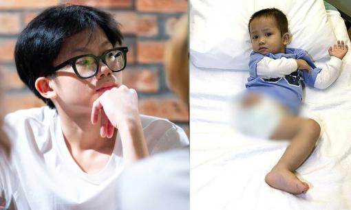 Diện mạo sau 19 năm của 'chú lính chì' Thiện Nhân bị bỏ rơi trong rừng và bị động vật tấn công làm mất một chân, toàn thân kiến bu kín