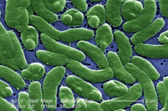 Vi khuẩn Vibrio Vulnificus là gì, ăn tôm, ăn hải sản