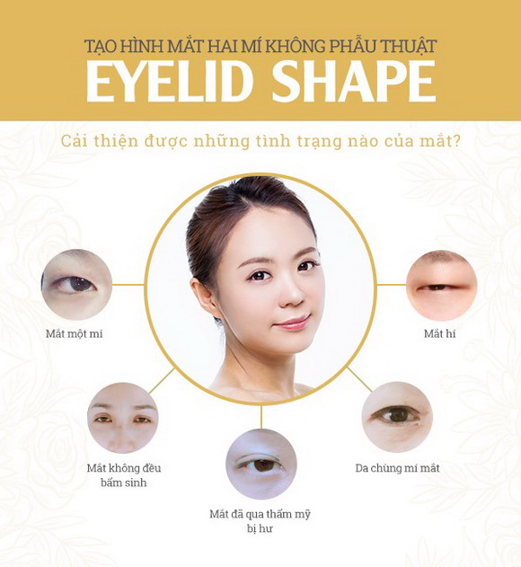 Tạo hình mắt hai mí, SHE CENTER, EYELID SHAPE, CEO Đỗ Thị Thu Mai