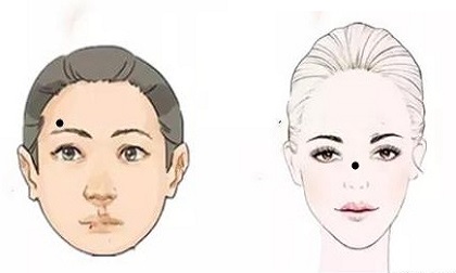 vị trí nốt ruồi phú quý, vị trí nốt ruồi may mắn, những vị trí nốt ruồi thu hút tài lộc