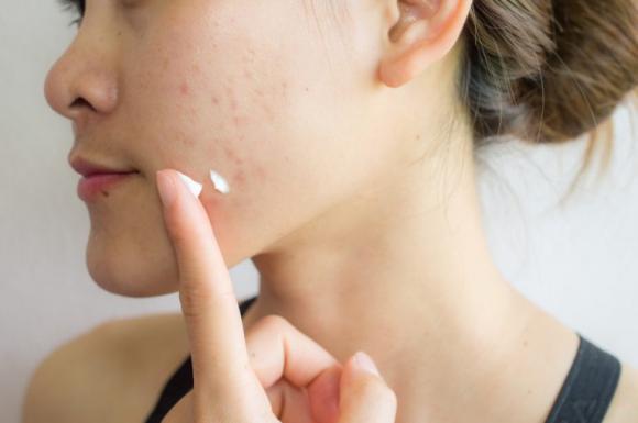 hạnh nhân, lợi ích của hạnh nhân, hạt tốt cho sức khỏe