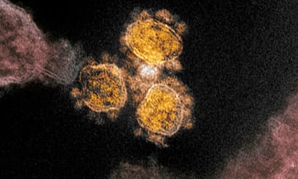 SARS-CoV-2, Covid-19, tình dục, virus, tinh dịch