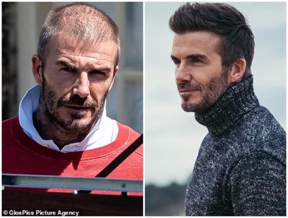 David Beckham,David Beckham hói đầu,sao Hollywood