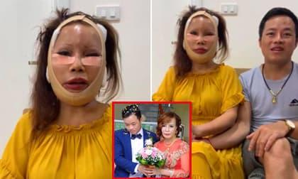 cô dâu 62 tuổi, Thu Sao, cô dâu 62 tuổi dao kéo