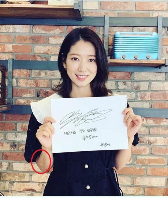 park shin hye, bầm tím, phim hàn