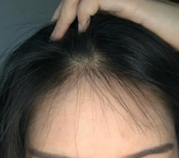 TÓC MÁI GIẢ CHE HÓI CHẤT LIỆU TÓC THẬT  D15  Xuân tóc giả hàng đường   httpsxuantocgiahangduongcom