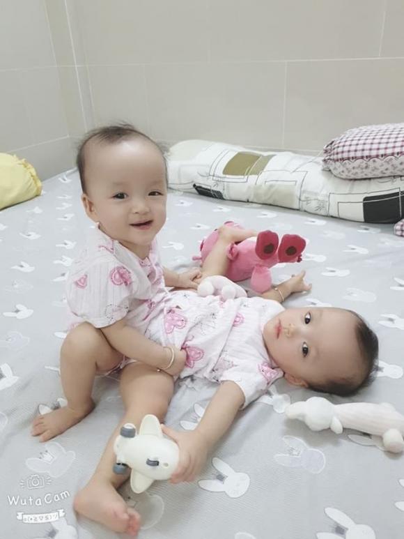 phẫu thuật cặp song sinh dính liền nhau, cặp song sinh dính liền thân, cặp song sinh dính liền
