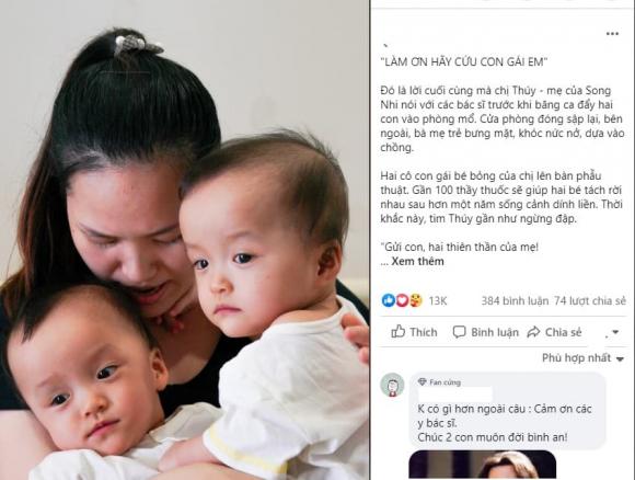 phẫu thuật cặp song sinh dính liền nhau, cặp song sinh dính liền thân, cặp song sinh dính liền