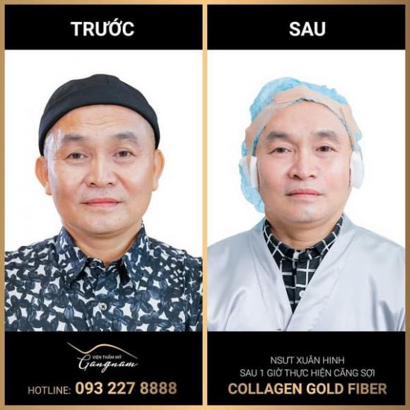 Thẩm mỹ Mega Gangnam, thẩm mỹ, 
