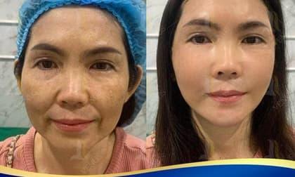 tái sinh đa tầng, giảm cân, Thẩm mỹ viện Quốc tế Venus
