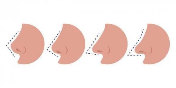 Những người thích ngoáy mũi sẽ sớm phải chịu 3 hậu quả!