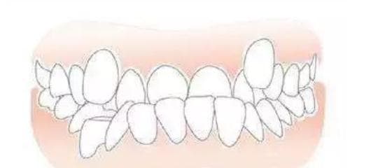 tướng miệng, hàm răng, nhìn tướng 