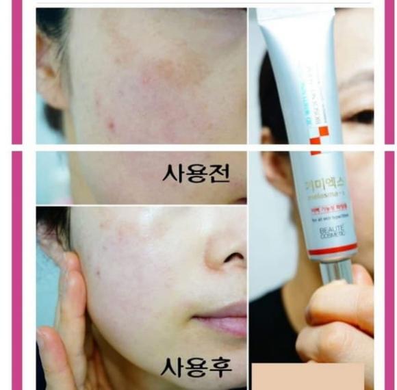 Melasma-x 3D Whitening Clinic Cream, mỹ phẩm hàn quốc, nám da