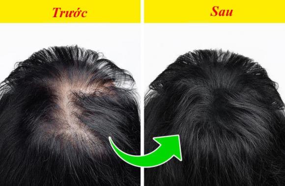 4 mẹo giúp tóc mọc nhanh hơn trông thấy