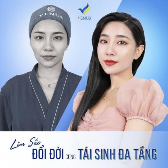 tái sinh đa tầng, giảm cân, Thẩm mỹ viện Quốc tế Venus