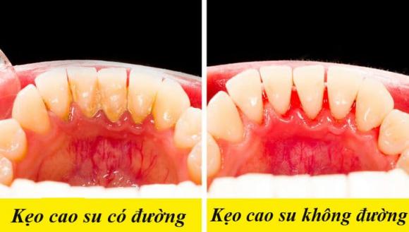 kẹo cao su, ảnh hưởng của kẹo cao su, kiến thức 