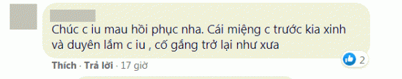 cô dâu 62 tuổi, cô dâu thu sao, cô dâu thu sao biến chứng thẩm mỹ