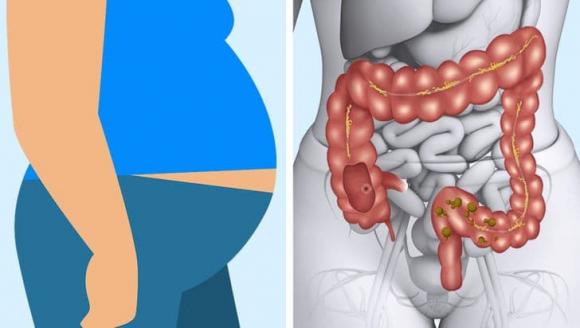 ăn quá nhiều thịt, dấu hiệu ăn quá nhiều thịt, thói quen có hại, sai lầm khi ăn thịt