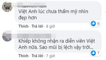 Bằng Kiều, Việt Anh, Việt Anh sau thẩm mỹ, sao việt