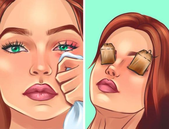 túi trà, công dụng của túi trà