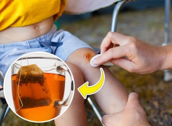 túi trà, công dụng của túi trà