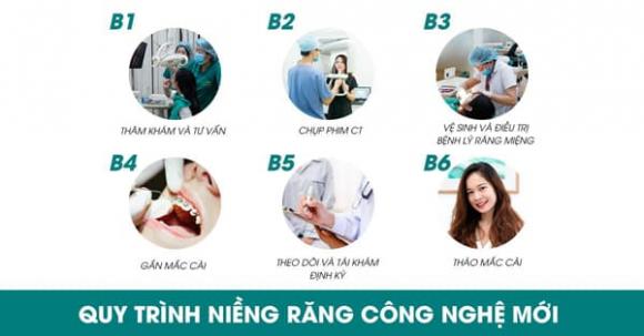 queen-smile-611-1-ngoisaovn-w600-h314 1 Niềng răng công nghệ mới, Nha khoa thẩm mỹ Queen Smile
