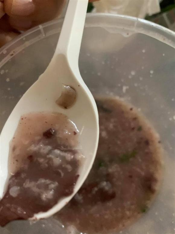 vật thể lạ trong đồ ăn, móng tay trong tô cháo, móng tay trong đồ ăn