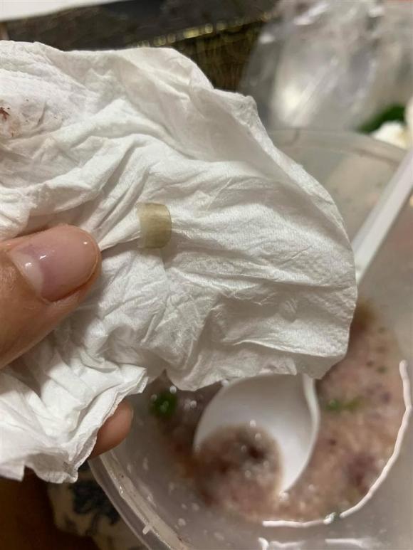 vật thể lạ trong đồ ăn, móng tay trong tô cháo, móng tay trong đồ ăn