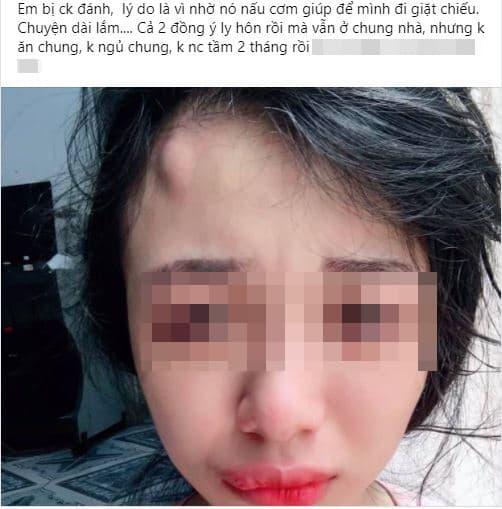 ly thân, ly hôn, bị chồng đánh