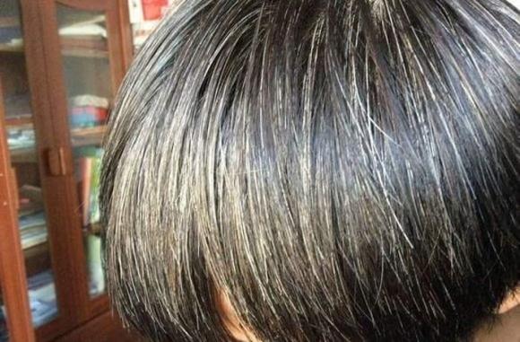 View - Thiếu vitamin nào sẽ gây ra tóc bạc ở cơ thể con người? Làm thế nào để ngăn ngừa tóc bạc xuất hiện?