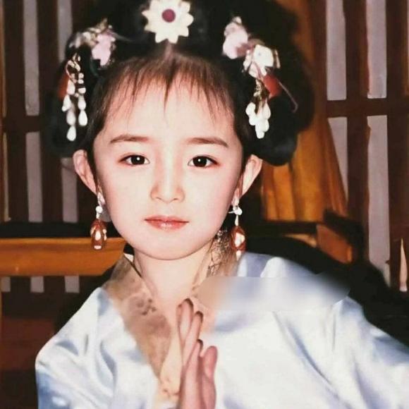 bệnh mắt, mắt,