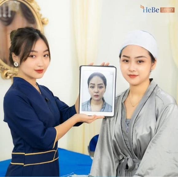 hebe-luxury-812 (1).jpg 0 Hebe Luxury, gò má cao, Thẩm mỹ viện Quốc tế Hebe Luxury