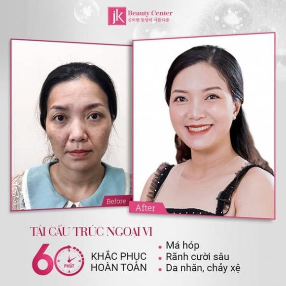 Phòng khám chuyên khoa thẩm mỹ JK Việt Nam, Tái cấu trúc ngoại vi, trẻ hóa da