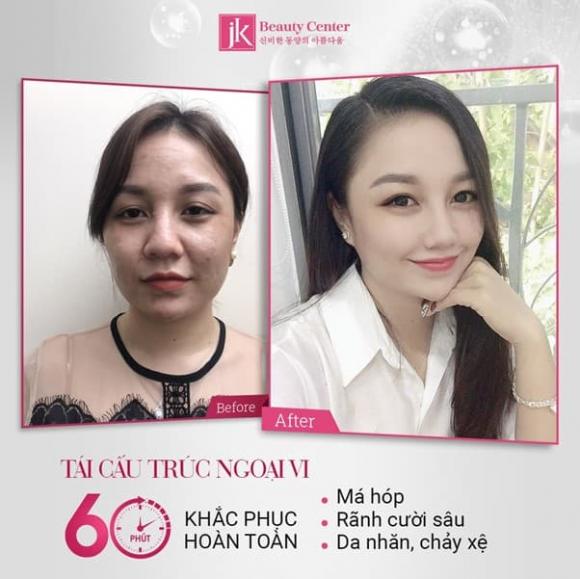 Phòng khám chuyên khoa thẩm mỹ JK Việt Nam, Tái cấu trúc ngoại vi, trẻ hóa da