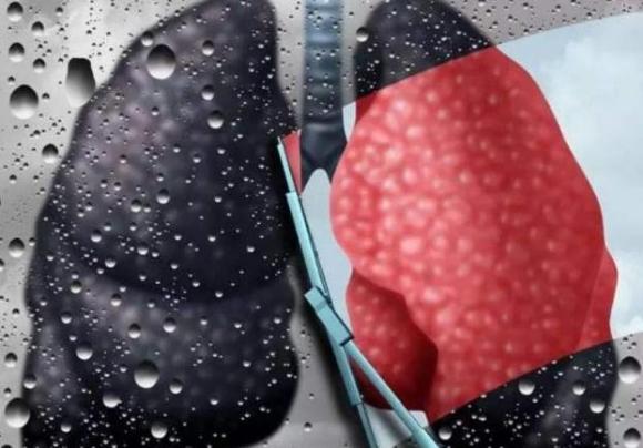 bỏ thuốc lá, tuổi nào tốt để bỏ thuốc lá, cách cai thuốc lá