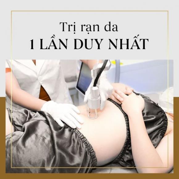 tri-ran-da-912 (1).jpg 0 Trị rạn da, Venus by Asian