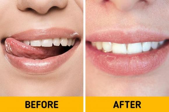 sức khỏe, sức khỏe vào mùa đông, chăm sóc sức khỏe vào mùa đông
