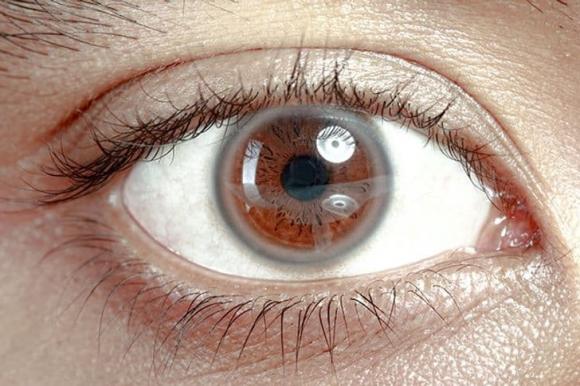 bệnh mắt, đau mắt, sức khỏe